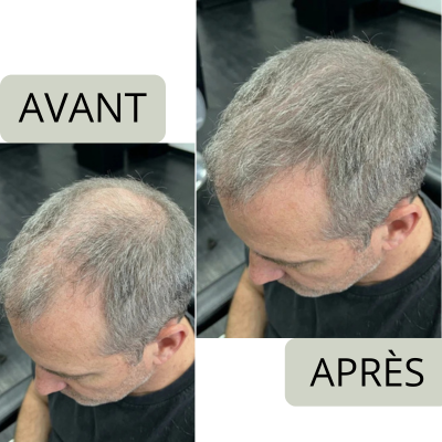 Laurent B.